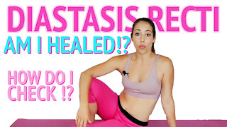 Is My Diastasis Recti Healed? How do I know when Diastasis Recti is Healed and how to check