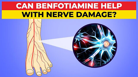 Can Benfotiamine Help With Diabetic Nerve Damage?