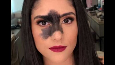 Model becomes famous over birthmark on face