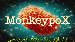 Monkeypox | All you need to know | Dr Aamir Thazvi | Dr Aamir Malik