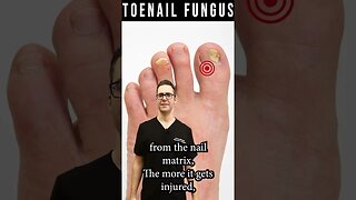How to Know If Toenail Fungus is Dying? [How Fast Do Nails Grow?]