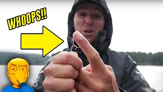 Best Way To Remove A FISHING HOOK. Real Life Demonstration!