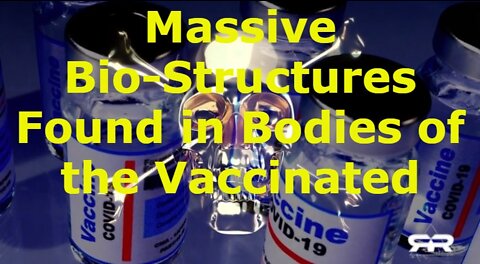 Massive Bio-Structures Found in Bodies of the Vaccinated