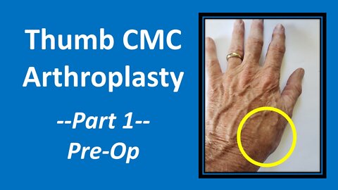 CMC Wrist Arthritis Surgery Pre Op