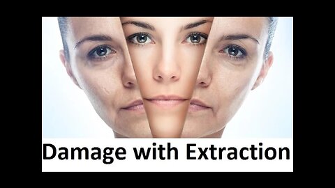 Does Tooth Extraction Damage Face by Prof John Mew