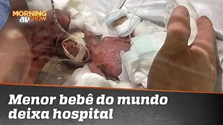 O menor bebê do mundo vai te emocionar