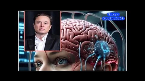 Vous êtes-vous déjà demandé comment fonctionne la puce Neuralink implantée dans le cerveau ?