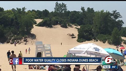 Swimming beach at Indiana Dunes State Park closed because of ‘foreign contamination’