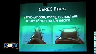 Integration of CEREC in Biological Dentistry