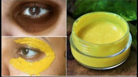 How to Remove Dark Circles & Eye Bags Naturally in 3 Days