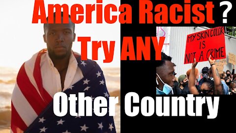 Think America is Hateful + Racist? Try ... ANY Other Country