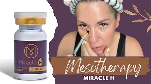 Mesotherapy with Miracle H | Does it hurt?