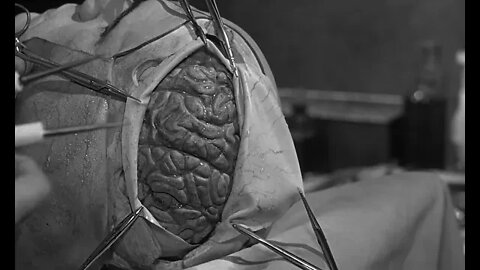The Brain That Wouldn't Die 1962 Full HD (El cerebro que no moriría 1962 Full HD)
