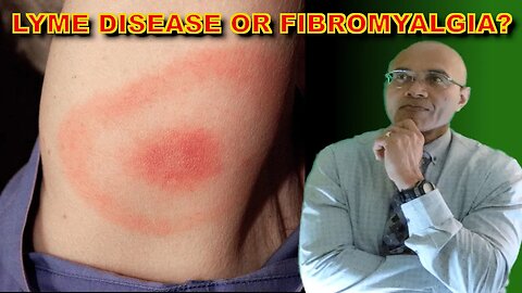 Lyme Disease Or Fibromyalgia? (Which is it?)