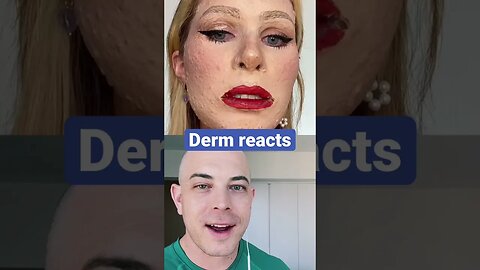 Dermatologist reacts to crazy face peel!