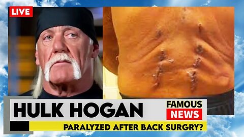 Is Hulk Hogan Paralyzed? WWE Legend Can’t Feel His Legs | Famous News