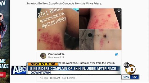 Drying agent reportedly burns riders at San Diego Supercross