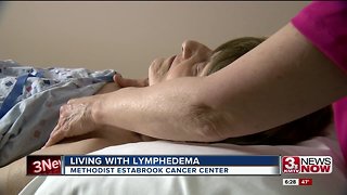 Living with Lymphedema