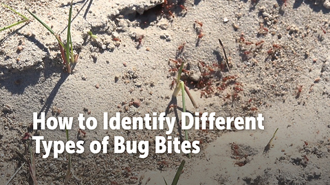 How to Identify Different Types of Bug Bites