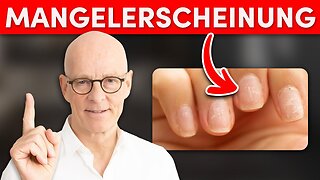 Das sagen Fingernägel über deine Gesundheit aus! (erstaunlich)@Dr. med. Ulrich Bauhofer