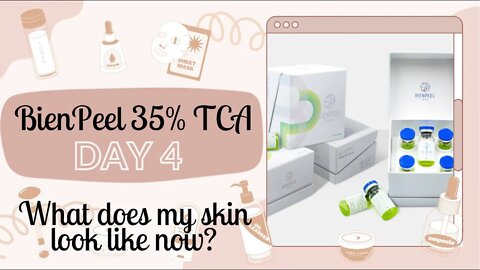 Day 4 BienPeel 35% TCA With & Without Skincare on Face