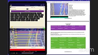 Discover Root Cause: General Overview and Entangled Insights