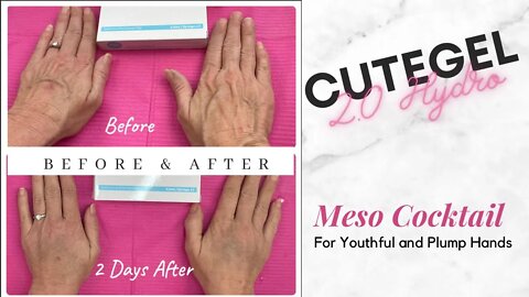 Youthful Hands using CuteGel 2.0 Cocktail