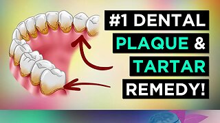 The BEST Remedies for Dental Plaque (Tartar)