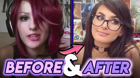 Sssniperwolf | Before and After | Plastic Surgery Rumours & Transformation
