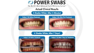 Power Swabs Teeth Whitening - March 2021
