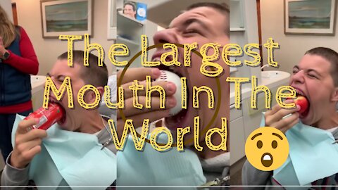 Orthodontist Reacts! The Largest Mouth In The World