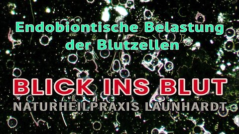 Blick ins Blut.Endobiontisch belastete Blutzellen@Naturheilpraxis Launhardt🙈