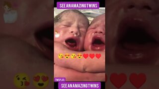 See an amazing twins #shors