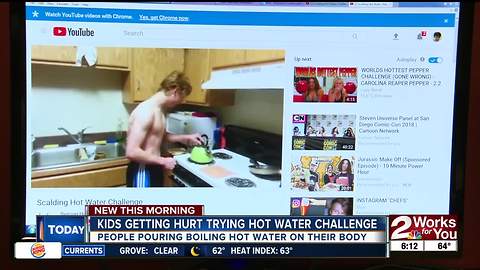 "Hot Water Challenge" sending kids to hospitals nationwide