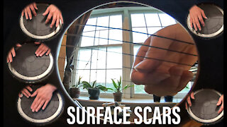 Surface Scars - Martin Guitar and Partsocaster
