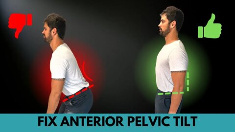 My Secret Trick To Quickly Fire Up The Glutes & Core In 12 Min | Perfect for Anterior Pelvic Tilt