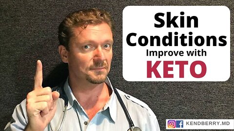 9 Skin Conditions Improved with KETO - 2021 (Acne, Eczema, Psoriasis...)
