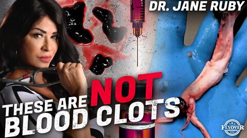 Dr. Jane Ruby Blows Lid Off the Clot Shot with Photos & Proof from Embalmers | Flyover Conservatives