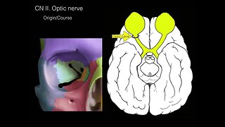 Cranial nerves I and II