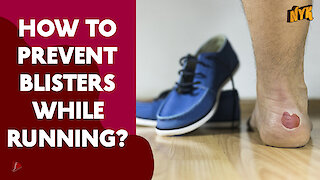 How To Prevent Blisters While Running?