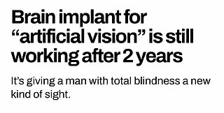 Brain Implant Restores Vision‼️👀