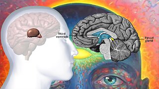 Decalcify Pineal Gland👁️