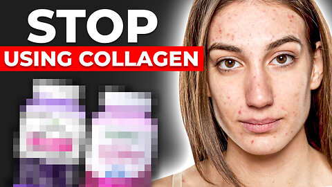 Collagen Is Detrimental To Your Health, Youth, And Strength