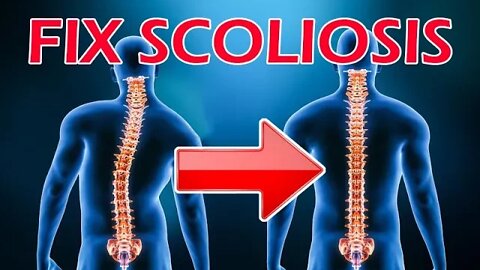 Do This Simple Exercise For Scoliosis