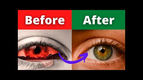 How to restore eye vision naturally in 2022 (secret exposed)