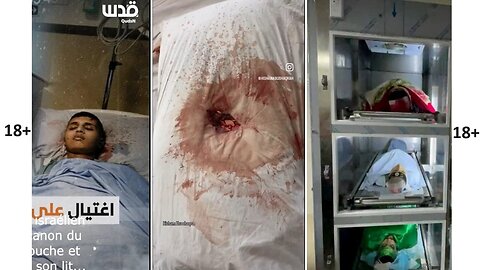 Jews storm hospital in West Bank disguised as doctors killed three Wounded Palestinians 18+