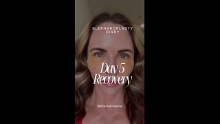 Eyelid Lift Surgery Recovery | Day 5