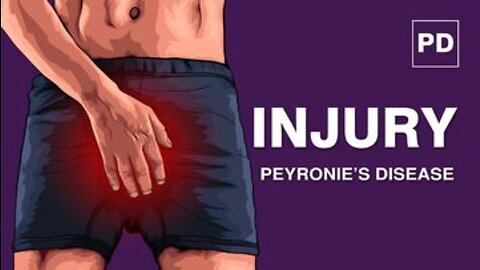 Peyronie’s Disease and Injury | How Small Injury Causes Peyronie's Disease | Mansmatters