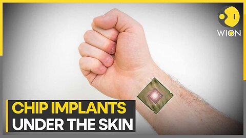 Human chip implants: Are they successful?