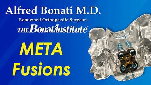 Dr. Bonati discusses new metamaterials used in spine fusions